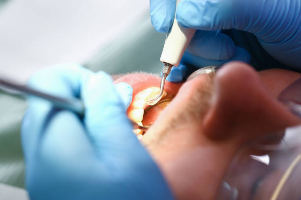 Best Emergency Dental Care for Broken or Chipped Teeth in Mont Alto, PA
