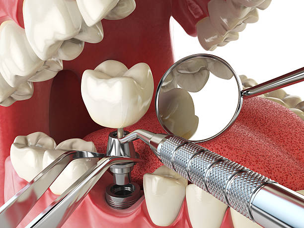Best Emergency Dental Care for Broken or Chipped Teeth in Mont Alto, PA